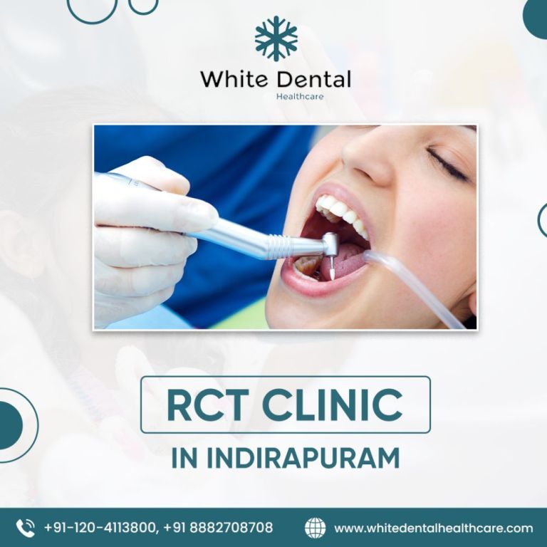 best-rct-clinic-in-indirapuram-big-0