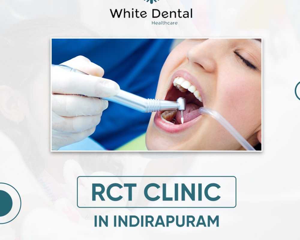 best-rct-clinic-in-indirapuram