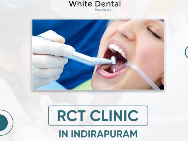 best-rct-clinic-in-indirapuram