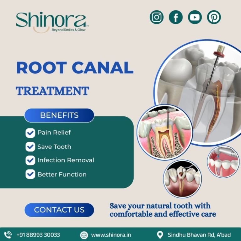 restore-your-smile-with-root-canal-treatment-in-ahmedabad-big-0