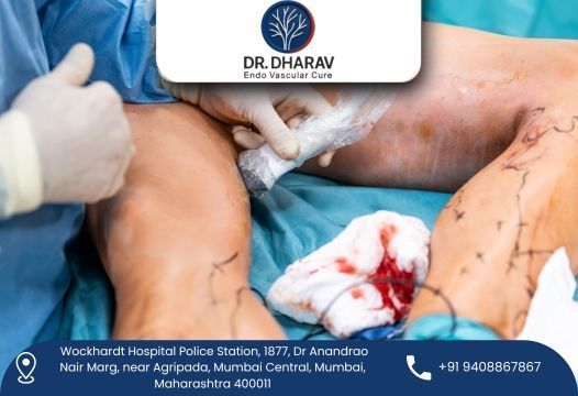drdharav-kheradia-endovascular-surgeon-in-india-big-0