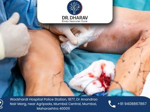 drdharav-kheradia-endovascular-surgeon-in-india