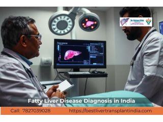 fatty-liver-disease-management-by-liver-specialists-small-0