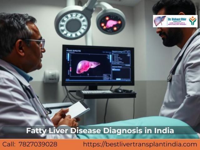 fatty-liver-disease-management-by-liver-specialists