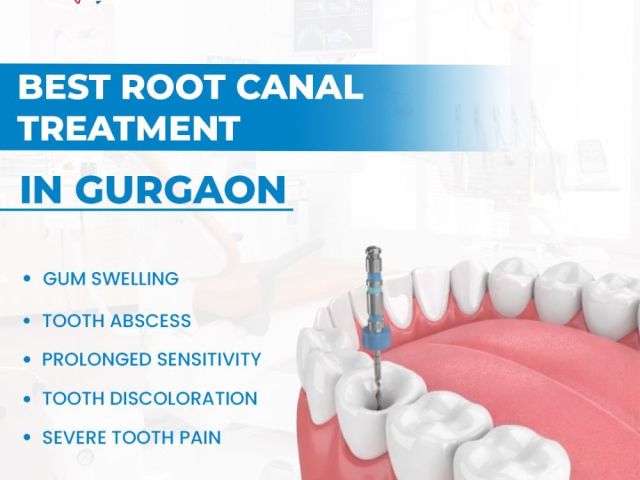 best-root-canal-treatment-in-gurgaon