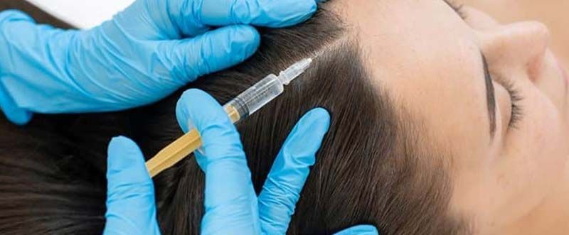 prp-treatment-for-hair-loss-aesthetic-dermatology-clinic-big-0