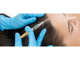 prp-treatment-for-hair-loss-aesthetic-dermatology-clinic-small-0