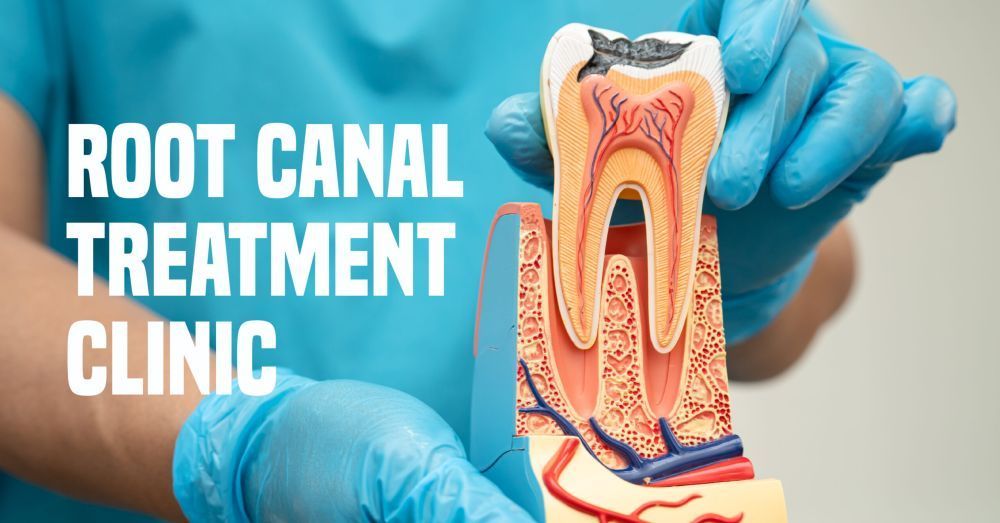 root-canal-treatment-in-hadapsar-big-0