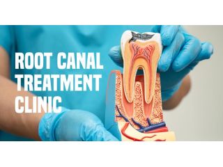 root-canal-treatment-in-hadapsar-small-0