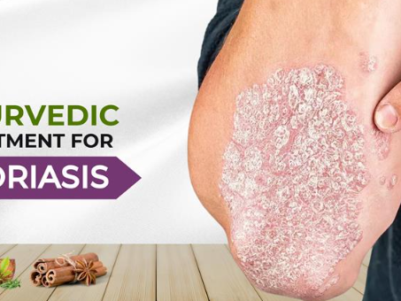how-ayurvedic-psoriasis-treatment-improves-skin-health