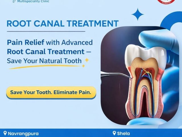 indias-leading-root-canal-treatment-with-high-success-rate