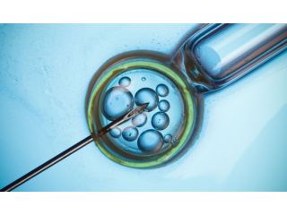advanced-laparoscopic-treatment-for-infertility-in-bareilly-small-0