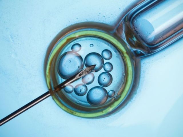 advanced-laparoscopic-treatment-for-infertility-in-bareilly