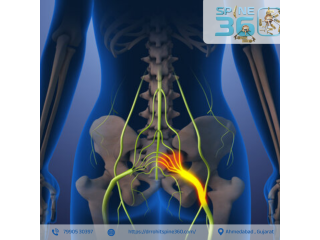 best-sciatica-specialist-in-ahmedabad-dr-rohit-thaker-small-0