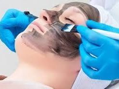instant-glow-therapy-carbon-peel-at-citrine-clinic-gurgaon