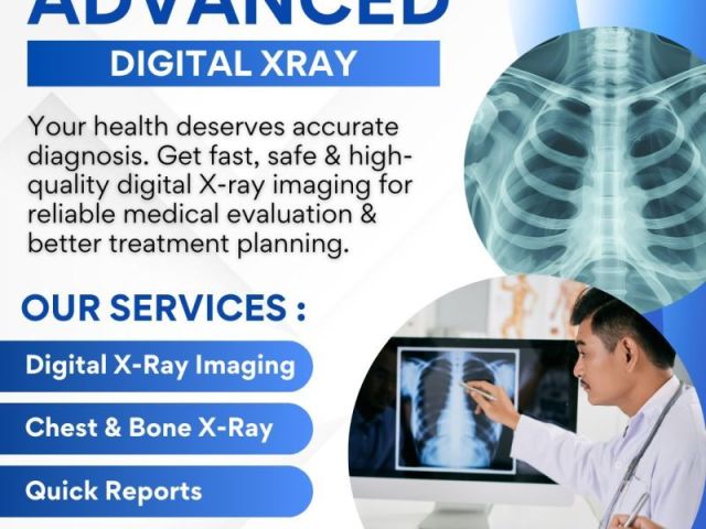 advanced-digital-x-ray-in-mumbra