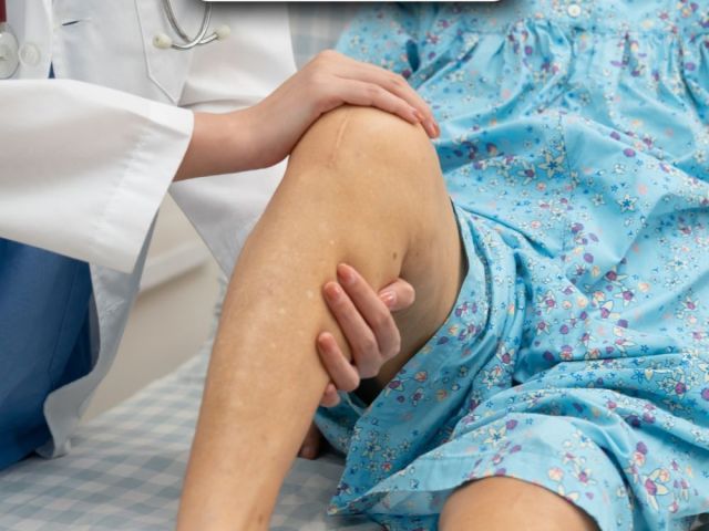 trusted-3d-robotic-knee-replacement-surgeon-in-ahmedabad