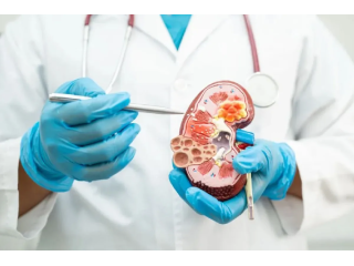 nephrology-hospital-in-gujarat-small-1