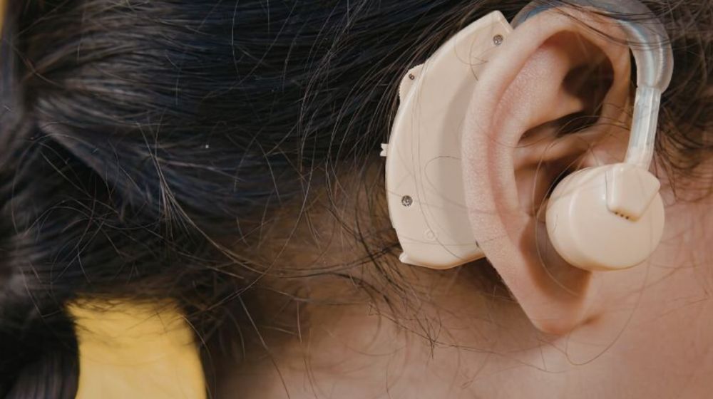 advanced-cochlear-implant-surgery-in-bhagalpur-bihar-big-0