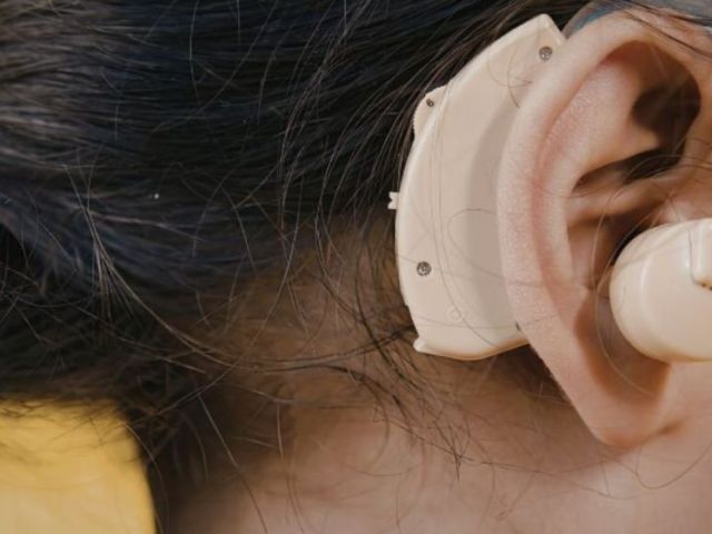 advanced-cochlear-implant-surgery-in-bhagalpur-bihar