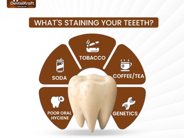 trusted-dentist-in-indirapuram-for-safe-and-modern-dental-care