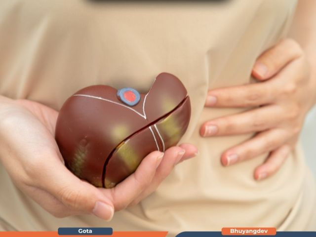 liver-transplant-in-ahmedabad-with-expert-medical-care