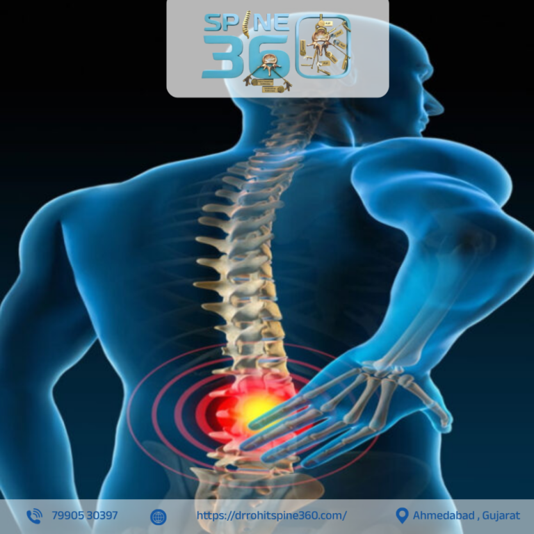 spinal-tuberculosis-specialist-in-ahmedabad-dr-rohit-thaker-big-0