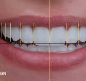 aesthetic-dentistry-clinic-in-chetla-for-smile-care-big-0