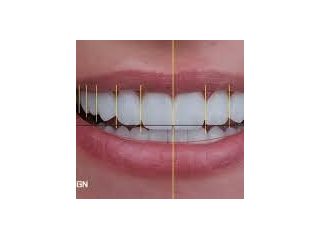 aesthetic-dentistry-clinic-in-chetla-for-smile-care-small-0