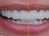 aesthetic-dentistry-clinic-in-chetla-for-smile-care