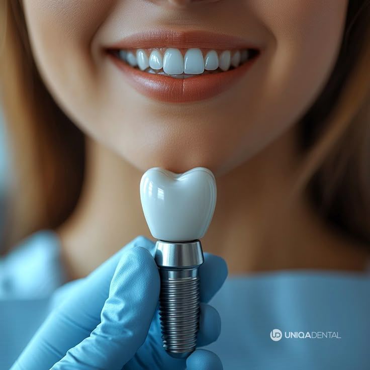 advanced-immediate-dental-implant-solution-at-smilesculptor-big-0