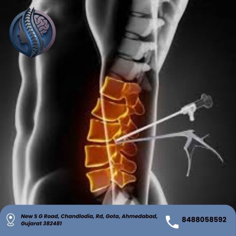 top-ube-spine-surgery-in-ahmedabad-dr-deep-parmar-big-0