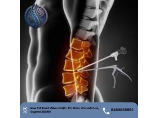 top-ube-spine-surgery-in-ahmedabad-dr-deep-parmar-small-0