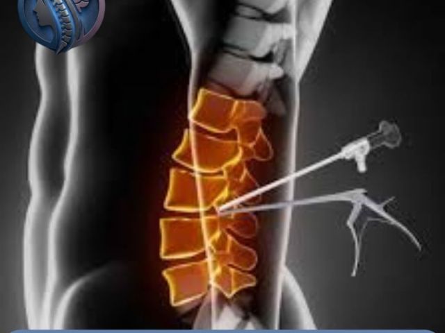 top-ube-spine-surgery-in-ahmedabad-dr-deep-parmar