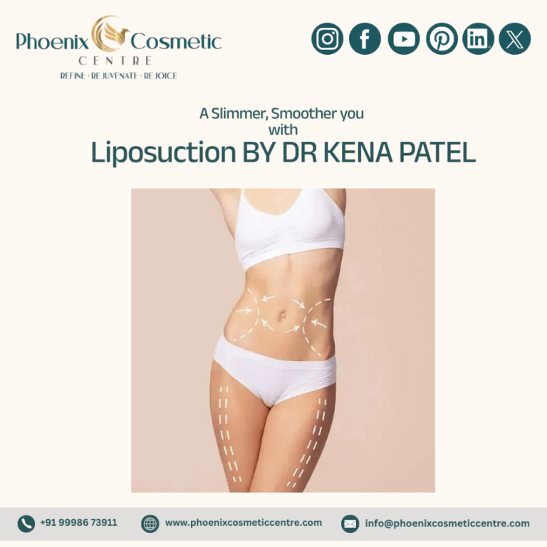shape-your-body-with-liposuction-surgery-in-ahmedabad-big-0