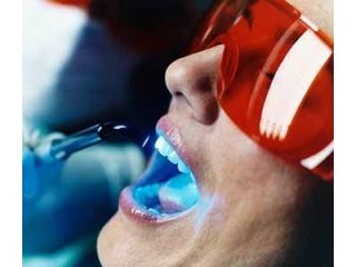gentle-laser-dental-care-in-trivandrum-small-0