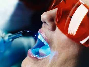 gentle-laser-dental-care-in-trivandrum