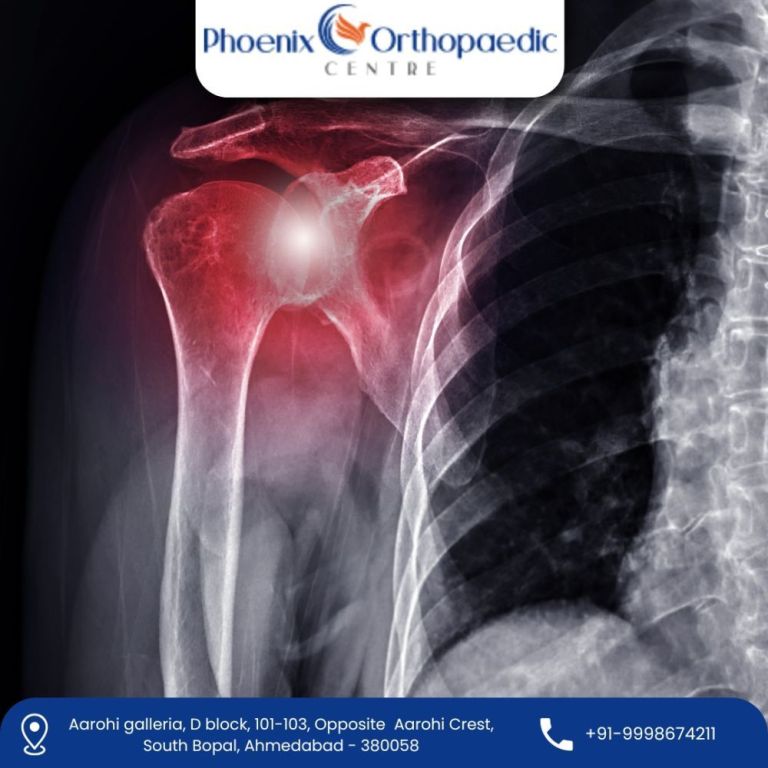 advanced-3d-robotic-shoulder-replacement-surgeon-in-ahmedabad-big-0