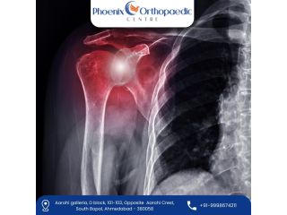 advanced-3d-robotic-shoulder-replacement-surgeon-in-ahmedabad-small-0