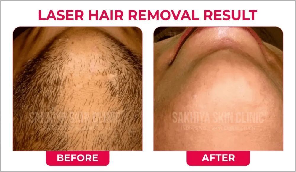 sakhiya-skin-clinic-noida-best-skin-hair-treatment-clinic-big-1