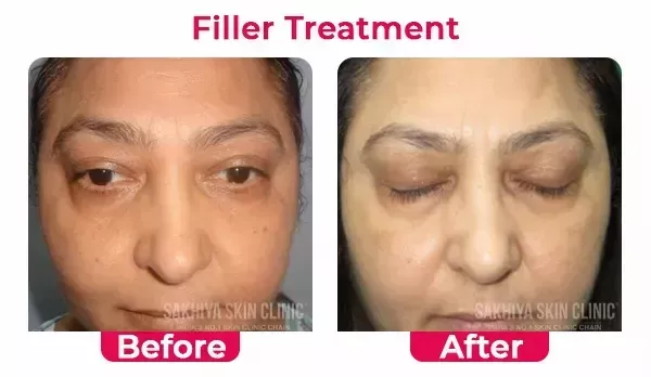 sakhiya-skin-clinic-noida-best-skin-hair-treatment-clinic-big-2