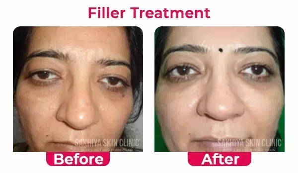 sakhiya-skin-clinic-noida-best-skin-hair-treatment-clinic-big-3