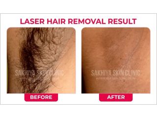 sakhiya-skin-clinic-noida-best-skin-hair-treatment-clinic-small-0