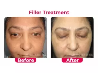 sakhiya-skin-clinic-noida-best-skin-hair-treatment-clinic-small-2