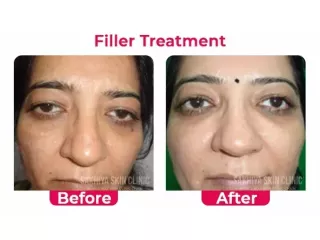 sakhiya-skin-clinic-noida-best-skin-hair-treatment-clinic-small-3