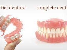dentures-clinic-in-sector-22-noida-call-us-8377990994