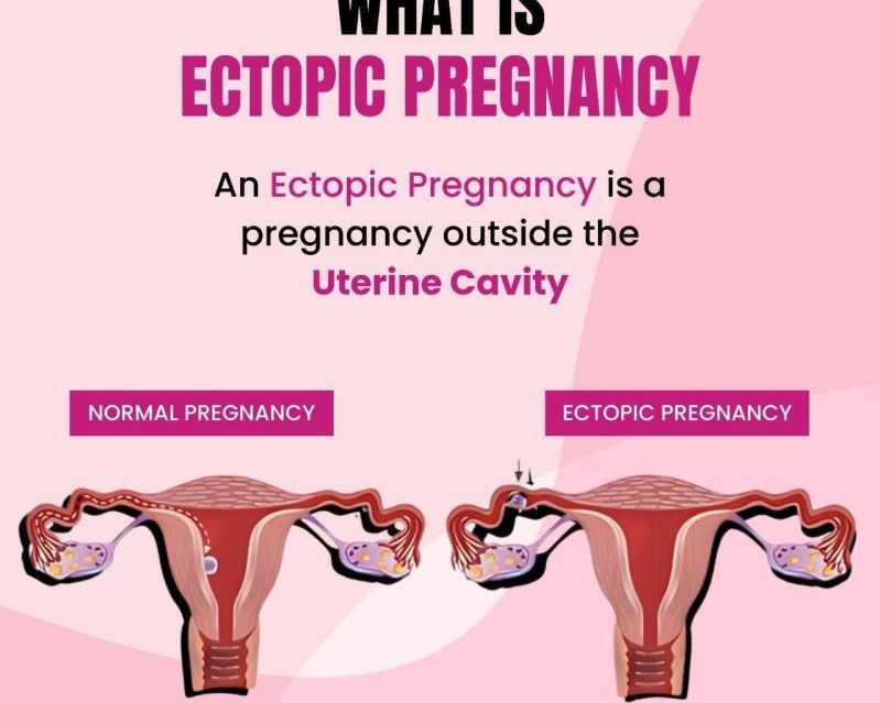 leading-gynecologist-in-ahmedabad-for-womens-health-care