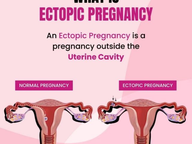 leading-gynecologist-in-ahmedabad-for-womens-health-care