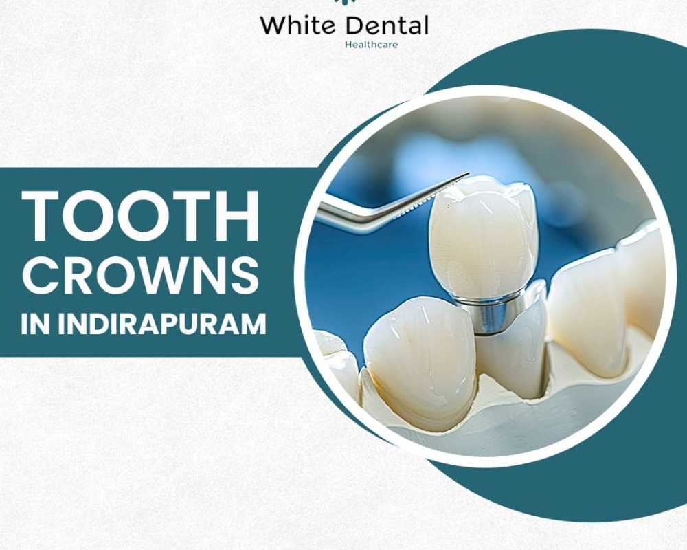 best-tooth-crowns-in-indirapuram-white-dental-healthcare