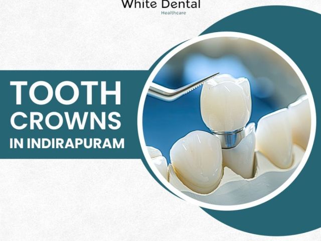best-tooth-crowns-in-indirapuram-white-dental-healthcare